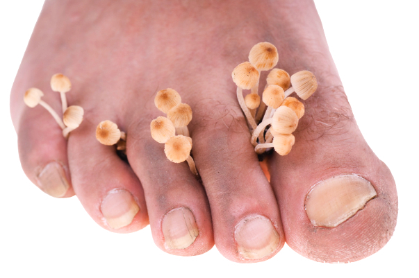 老农民治疗灰指甲的方法,一用就好,胜过几千块