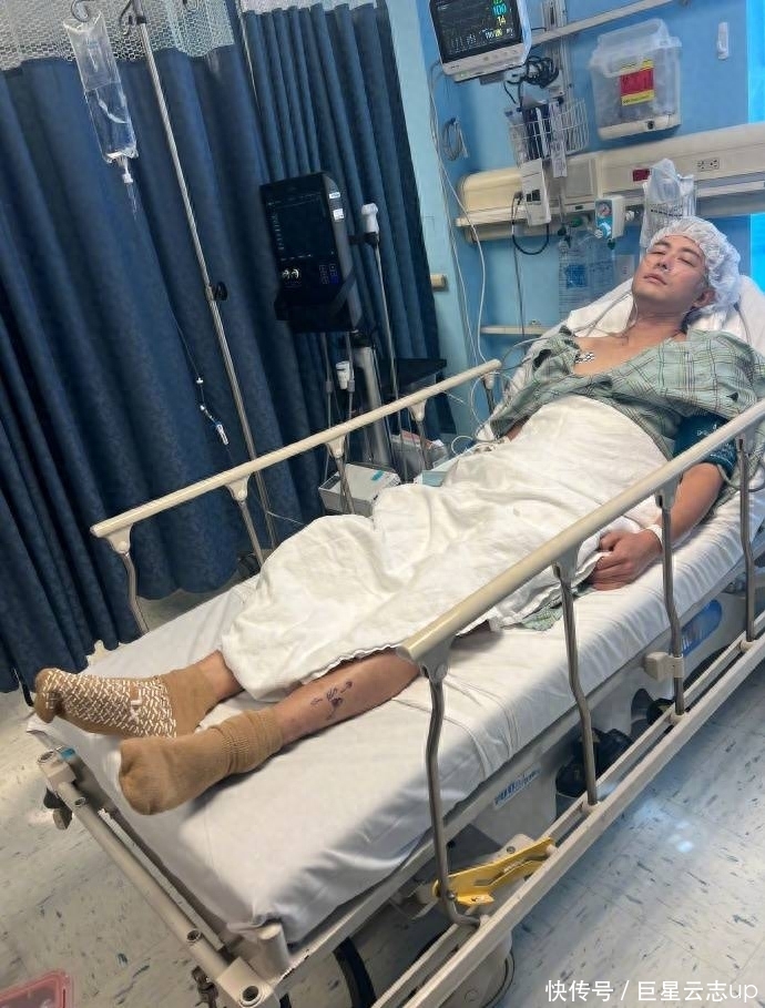 病床车怎么画陈学冬车祸受伤第三次手术，静躺病床满腿伤疤，头发全白模样憔悴_https://www.jmylbn.com_新闻资讯_第2张