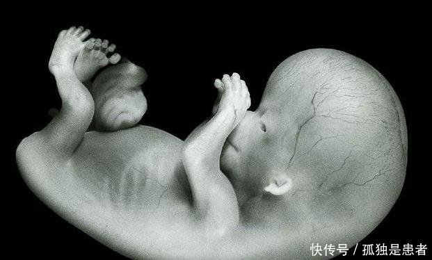 胎儿畸形有个''高峰期'',躲开这''三件事'',孕妈轻松