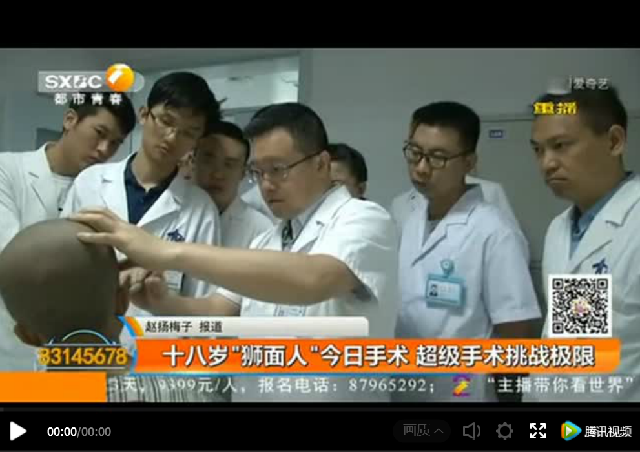 18岁\"狮面人\"今日康复出院 一附院多学科联合诊治再创奇迹