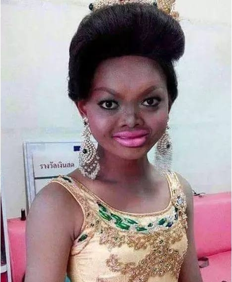 【奇闻】泰国丑女,逆袭成功成为国际名模,如今