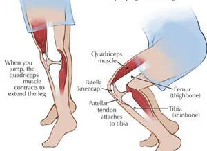 解强医生告诉你:静蹲在膝关节痛治疗中的作用
