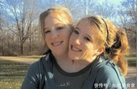 国外“连体姐妹花”爆红,嫁给同一男子,自曝生活方面有些艰难! MG电子注册导航