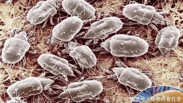 枕头用久了,上亿只螨虫陪你睡,教你一招,一辈子