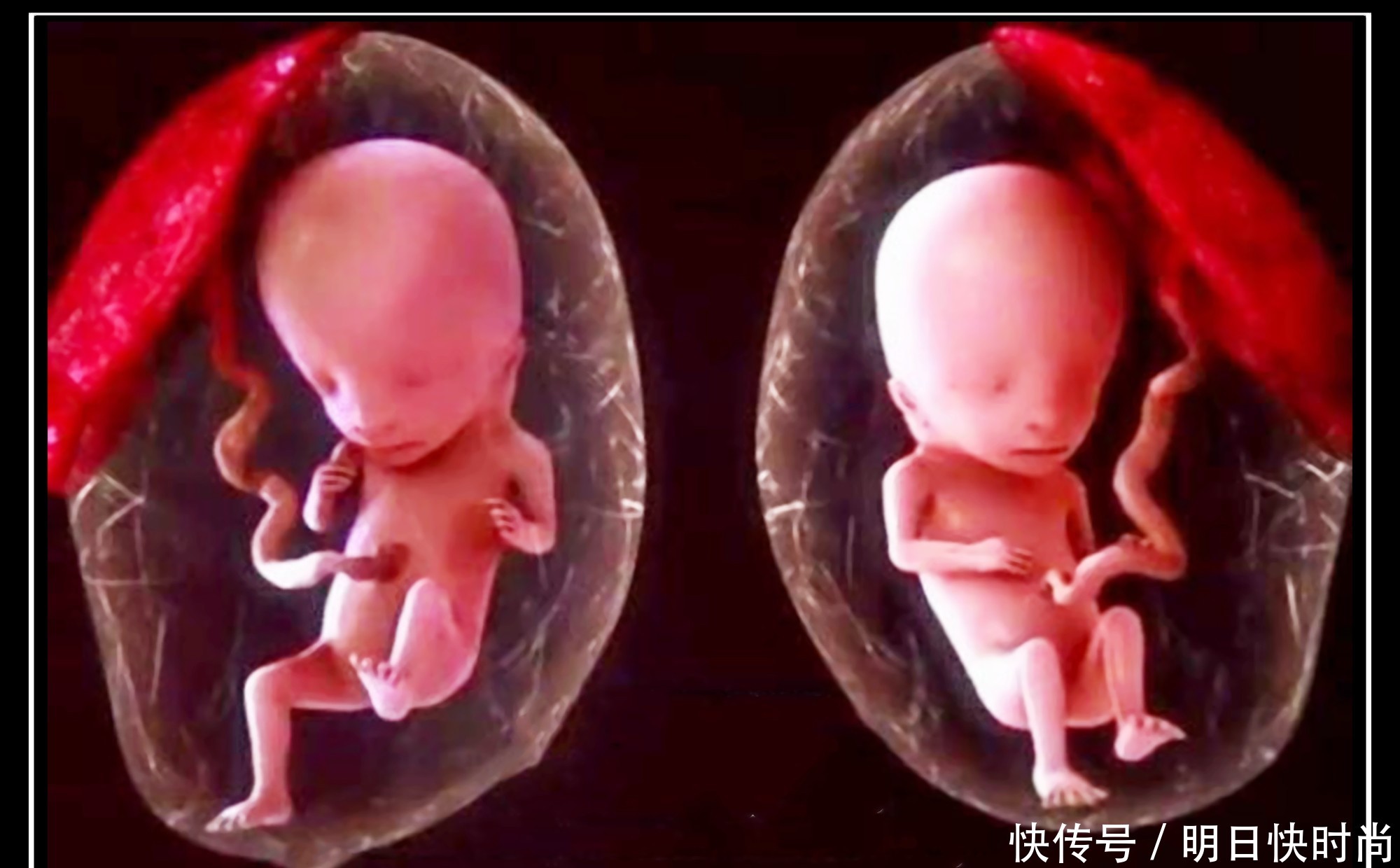如果孕期出现这6大症状，你很可能怀上双胞胎啦！