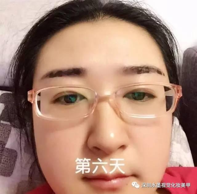 ②不碰水,不撕扯,忌口依旧 ③放松心态,别担心此时的眉毛是有点丑!