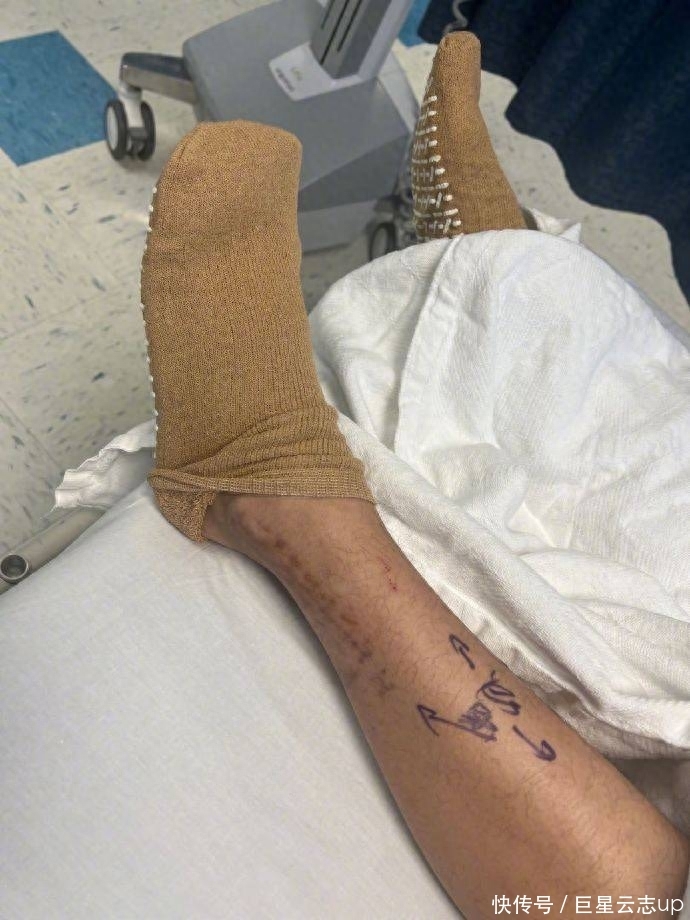 病床车怎么画陈学冬车祸受伤第三次手术，静躺病床满腿伤疤，头发全白模样憔悴_https://www.jmylbn.com_新闻资讯_第4张