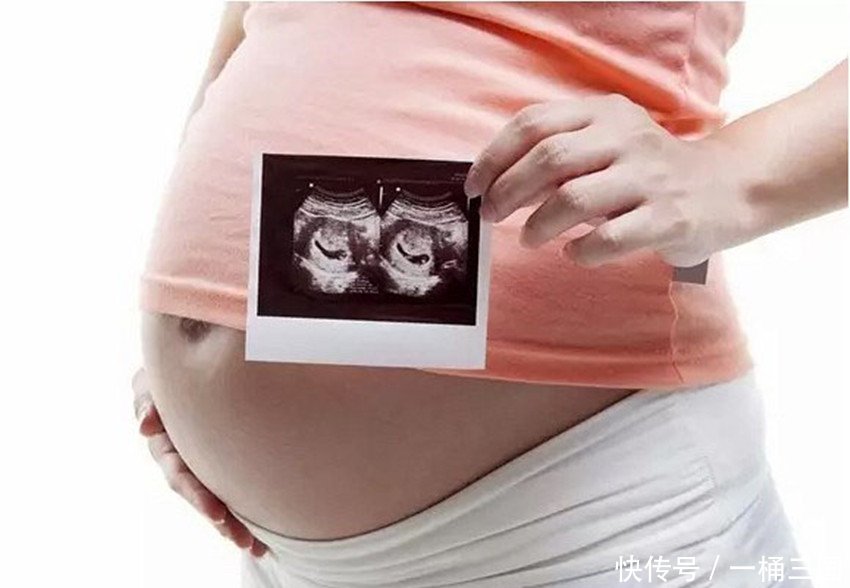 这两项产检项目很重要,如果有问题说明胎儿畸