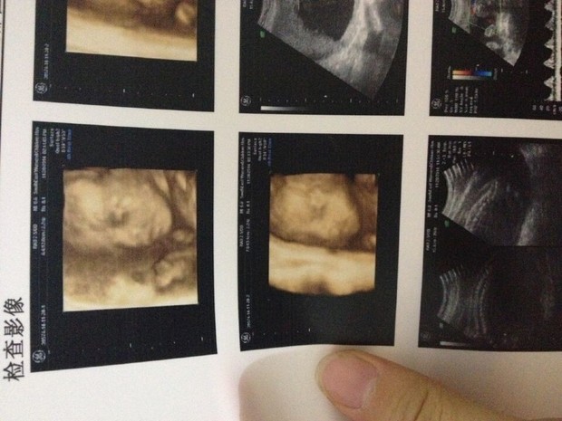 大家觉得是<em>女宝</em>还是男宝啊,有经验的宝妈们_3