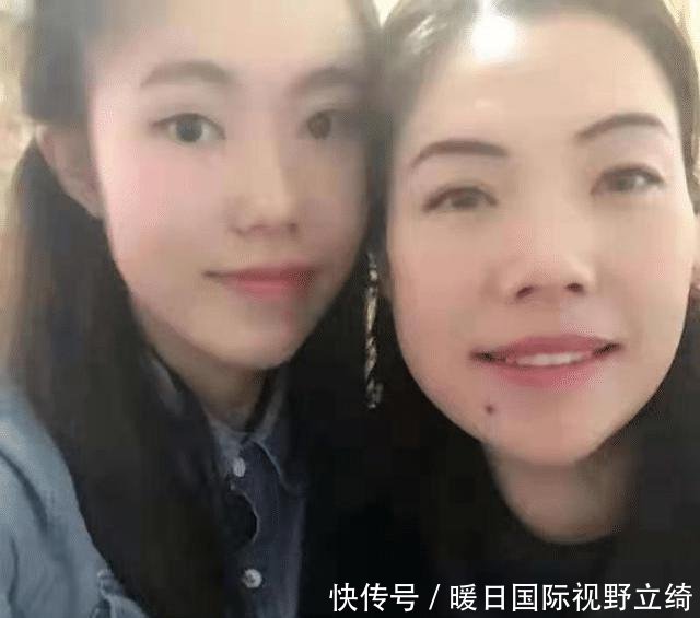 头被撞后多久确认没事