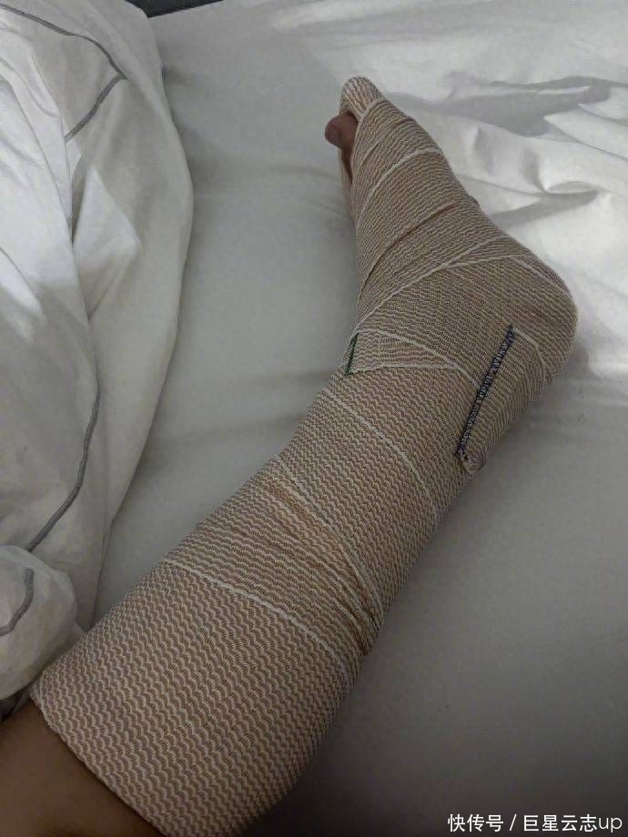 病床车怎么画陈学冬车祸受伤第三次手术,静躺病床满腿伤疤,头发全白模样憔悴_新闻资讯_第5张_活检穿刺产品网 病床车怎么画陈学冬车祸受伤第三次手术,静躺病床满腿伤疤,头发全白模样憔悴_https://www.jmylbn.com_新闻资讯_第5张