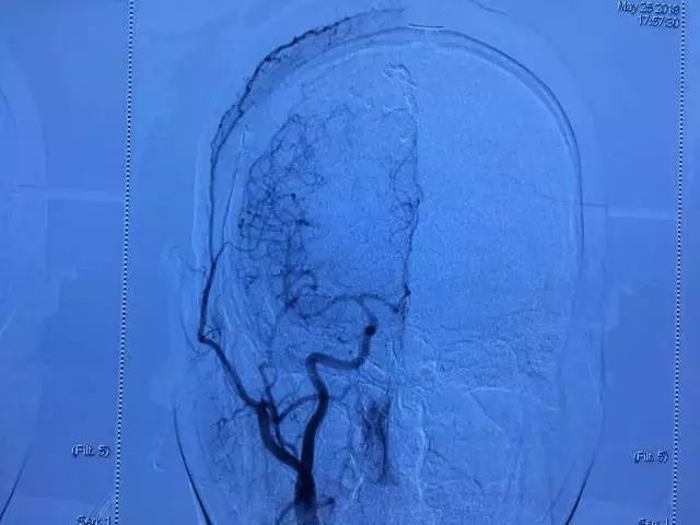 只要开 就是瘫?他们两个半小时成功\＂拆弹\＂ 实力给出回答