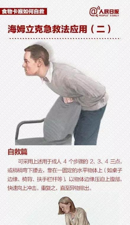 又一家长被呛窒息,海姆立克急救法每个男童都视频朱裕琳图片