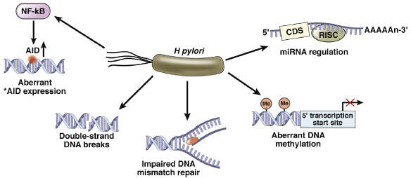 幽门螺杆菌阳性会得胃癌?你对\"胃癌菌\"了解多少?
