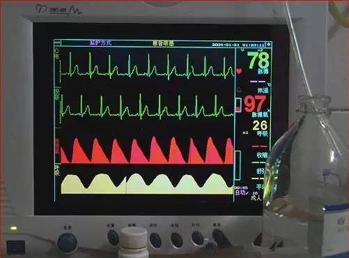 65岁老人从腹泻到死亡，仅仅12小时!