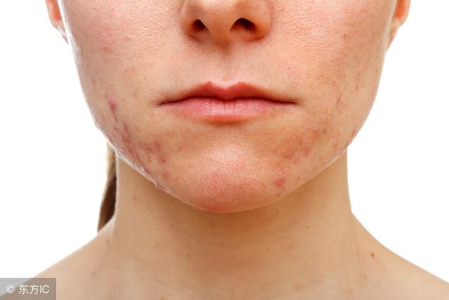 蒲公英被誉为最好的排毒草,泡水喝,要注意这