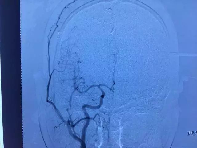 只要开 就是瘫?他们两个半小时成功\＂拆弹\＂ 实力给出回答