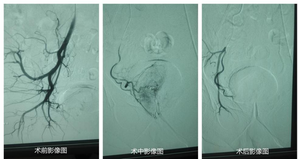 一晚小便六七次 别把老人夜尿多当\＂自然现象\＂