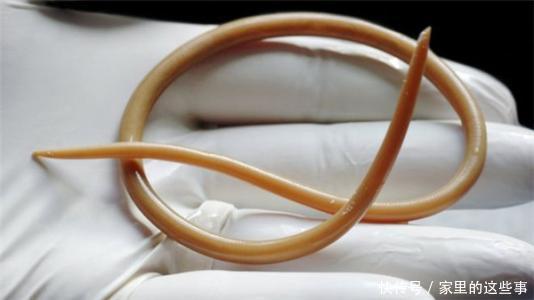 孩子脸上长白斑,经常肚子疼、不吃饭,医生:都是