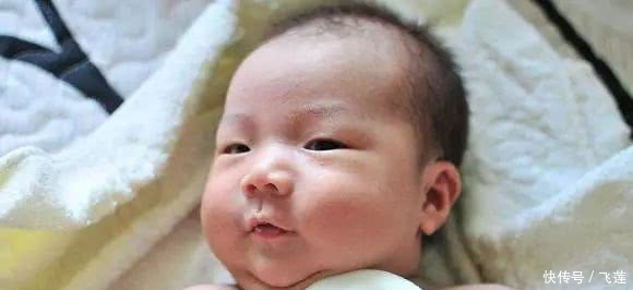 如何区分湿疹与痱子,且轻松应对