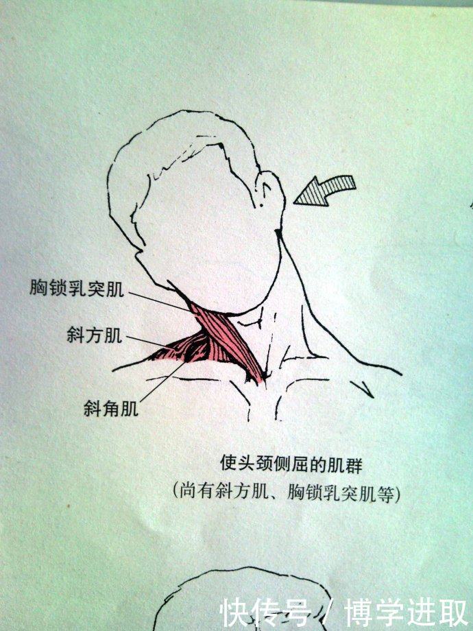 斜颈的症状有什么表现?