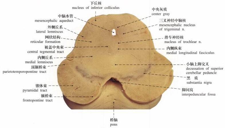 脑干腹侧面手绘