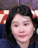 赵本山女儿后悔取出颊脂垫 十八九岁女生别轻易做