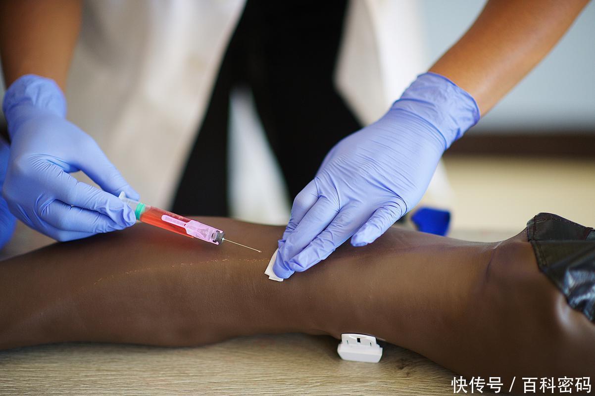 为什么输血不能用小针童年阴影“屁股针”,一针见效快还便宜!为啥现在基本不见了?_新闻资讯_第8张_活检穿刺产品网 为什么输血不能用小针童年阴影“屁股针”,一针见效快还便宜!为啥现在基本不见了?_https://www.jmylbn.com_新闻资讯_第8张