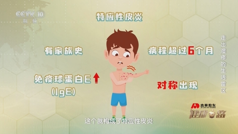 健康之路 《健康之路》 20241203 走出湿疹的生活雷区