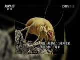 职场健康课 《职场健康课》 20160917 恼人的过敏性鼻炎