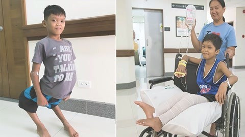 涨健识 男孩膝盖朝后像半人马恶魔，经神奇手术后改变人生