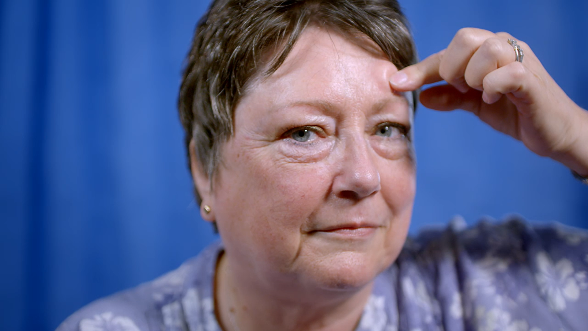 密密麻麻的囊肿