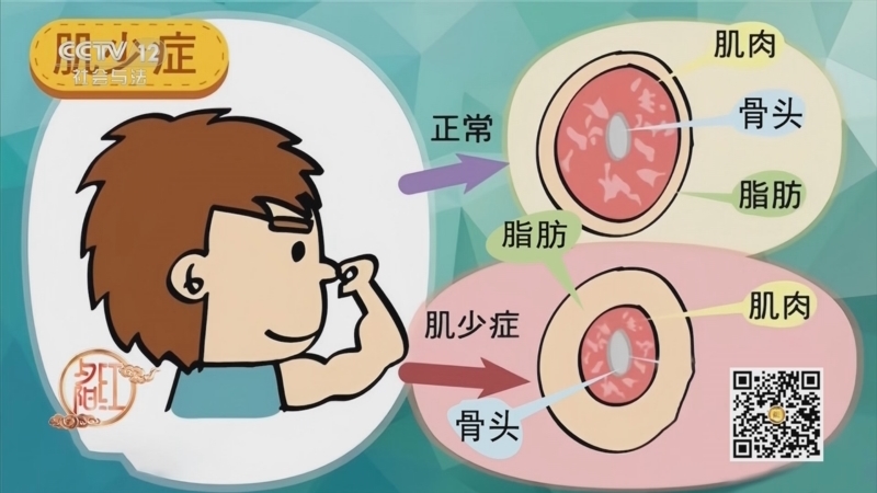 夕阳红 《夕阳红》 20250509 减重进行时——肥胖竟是“万病之源”？