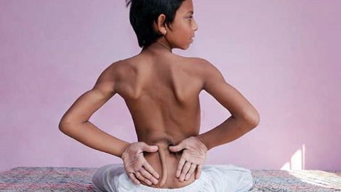 涨健识 花季少年天生长尾万人膜拜