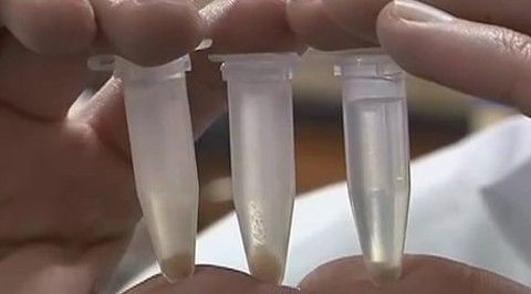 健康生活大调查 麻辣烫要人命 小伙吃后吐血数升