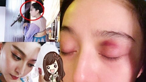萝莉说美女 第一季 盘点娱乐圈遭遇离奇意外的明星