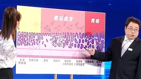 养生堂 2024 胃镜报告里的“暗语”