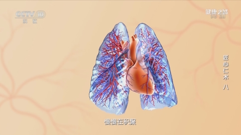 健康之路 《健康之路》 20220823 匠心仁术（八）