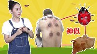 囧闻一箩筐 拔罐治病 老汉惊变