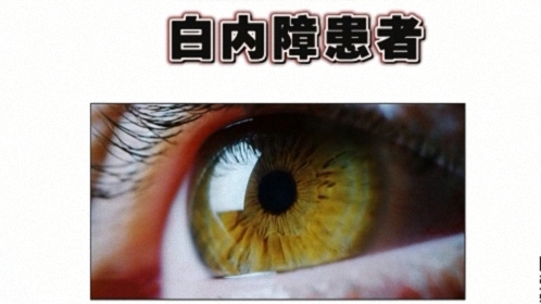 X诊所. 世界第一致盲眼病 白内障