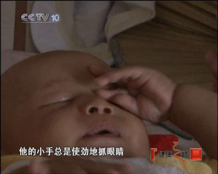 健康之路 “猫眼”之谜