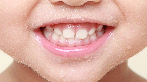 微笑的力量爱齿行动