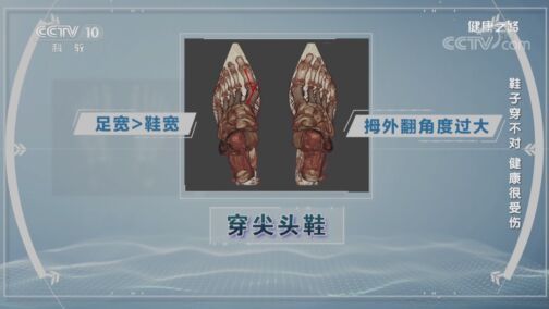 健康之路 《健康之路》 20200805 鞋子穿不对 健康很受伤
