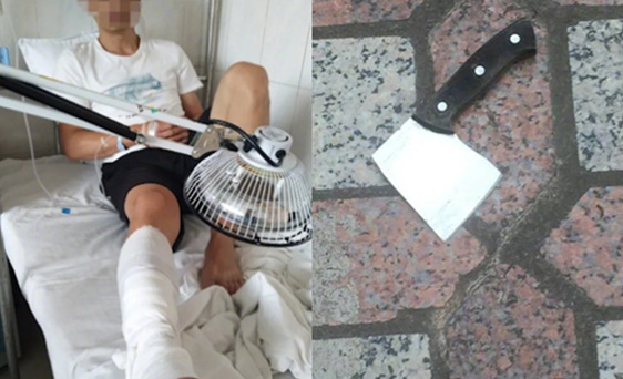天降 b>菜刀 /b> 南宁一男子的腿筋被砍断