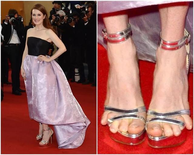 包括贝嫂,娜奥米·坎贝尔,克鲁尼婶在内的很多人都有这个毛病.