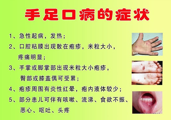 手足口病初期症状图