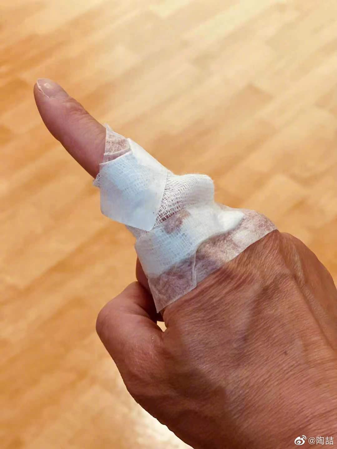 陶喆取出手指里15年的螺丝钢钉发长文回忆当年车祸细节