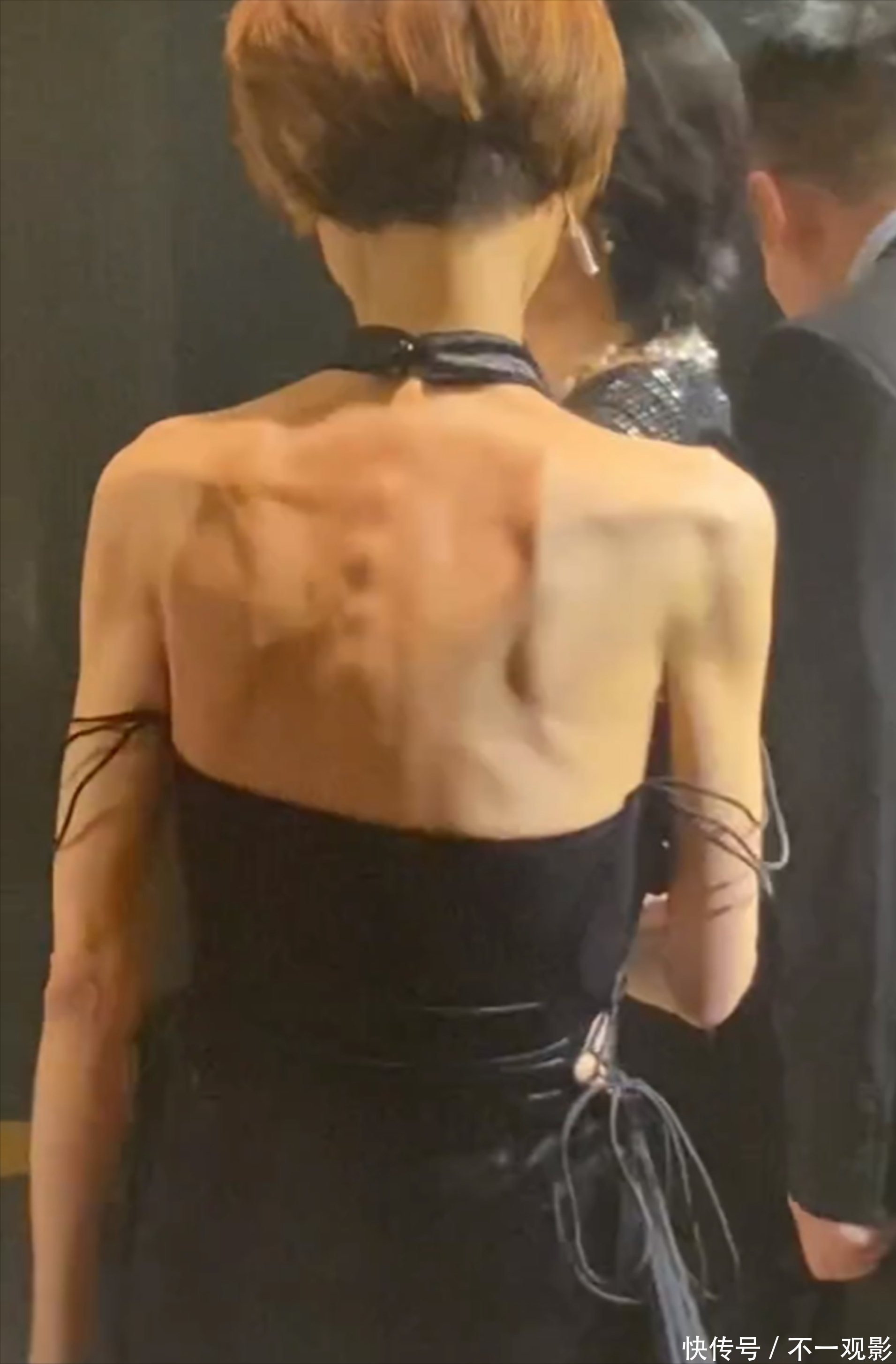 57岁叶子楣生图瘦到皮包骨脊梁骨突出两腿似竹竿正面身材震撼