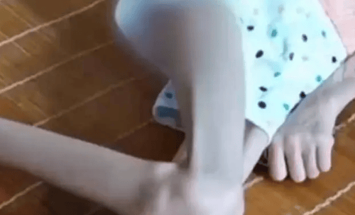 女孩零食当饭吃体重只有16斤