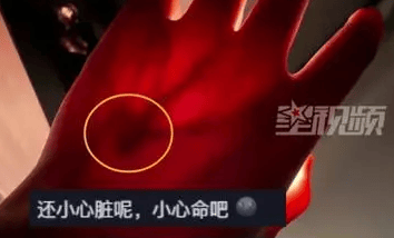 晒手电筒照手图被网友救一命
